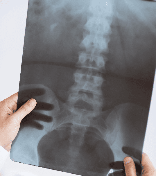 Ortopedista y Traumatólogo en CDMX